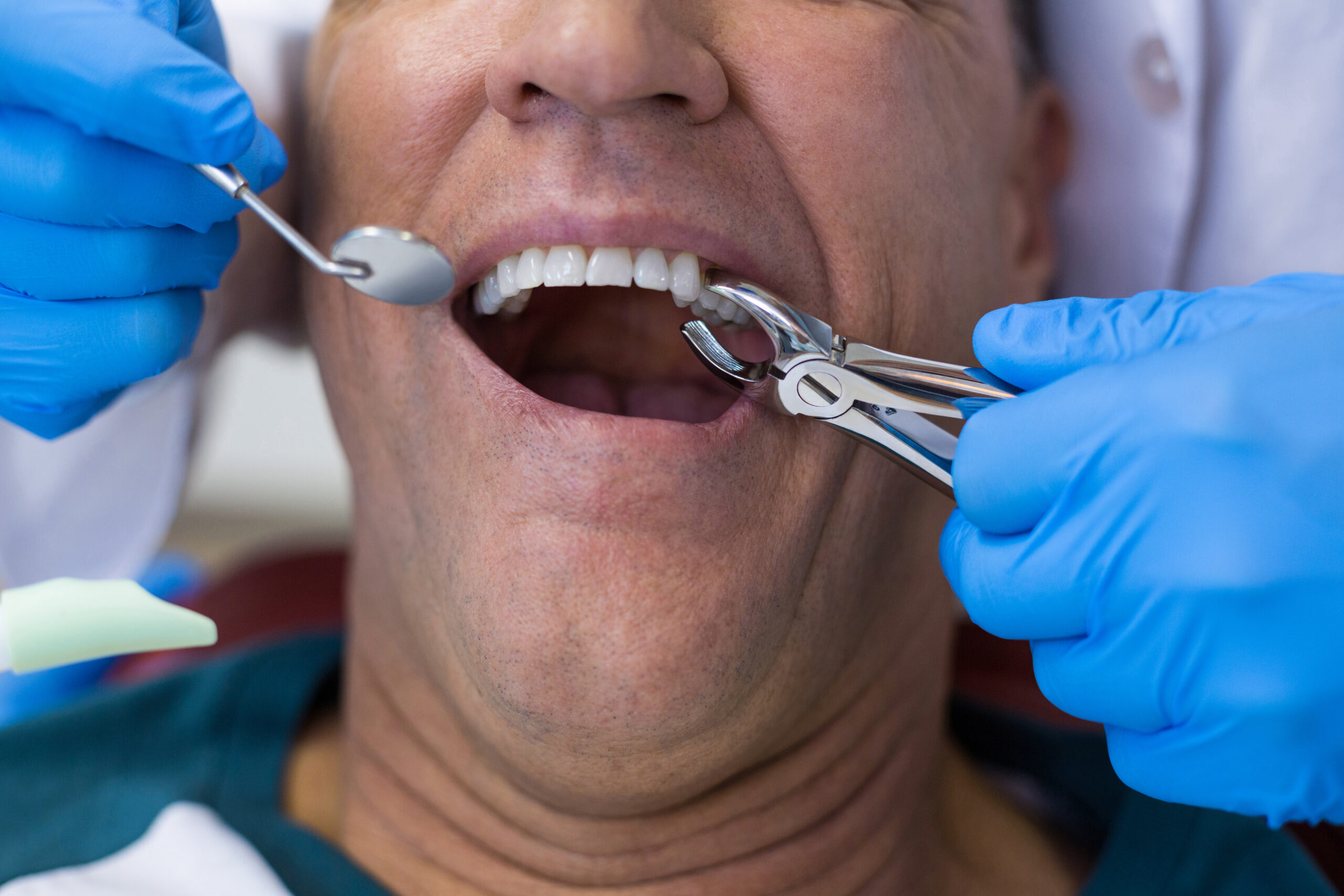 What to Expect Before and After Tooth Extractions