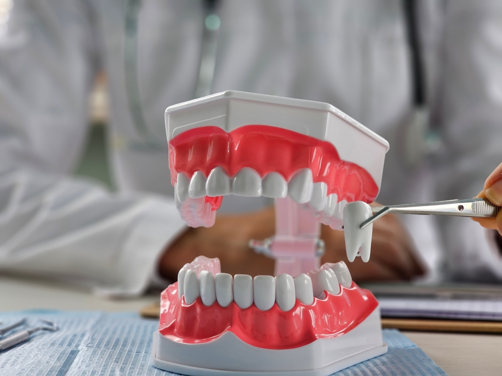 Wisdom Teeth Removal Sacramento