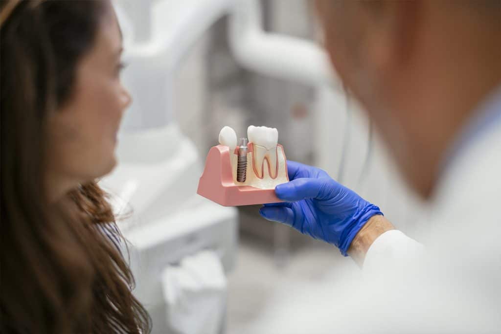 Dental Implants: Myths vs. Facts